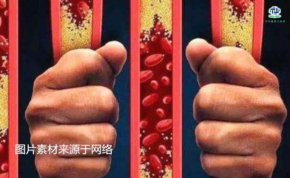 不想給血管&ldquo;添堵&rdquo;，盡量少吃以下這些東西，或許能讓腦梗離遠些  